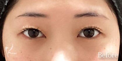Before写真