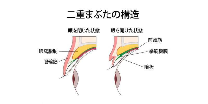 二重埋没法で二重ラインを形成する仕組み