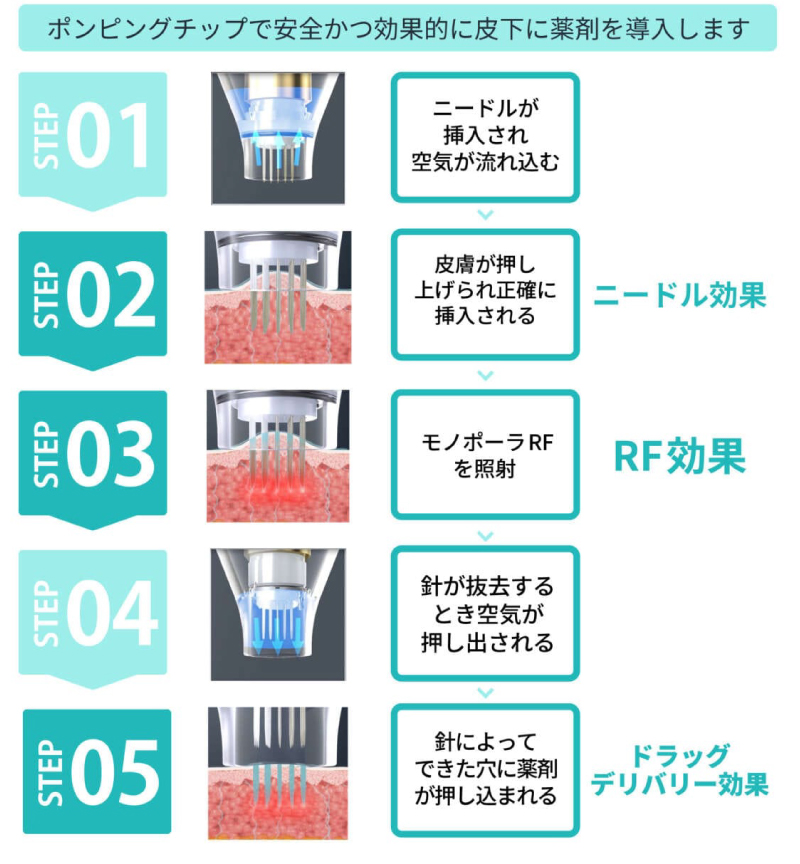 RFマイクロニードリング