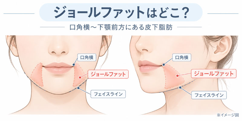 ジョールファットはどこ