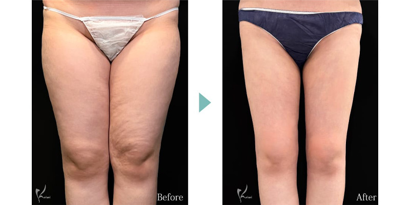 Before写真