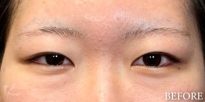 Before写真