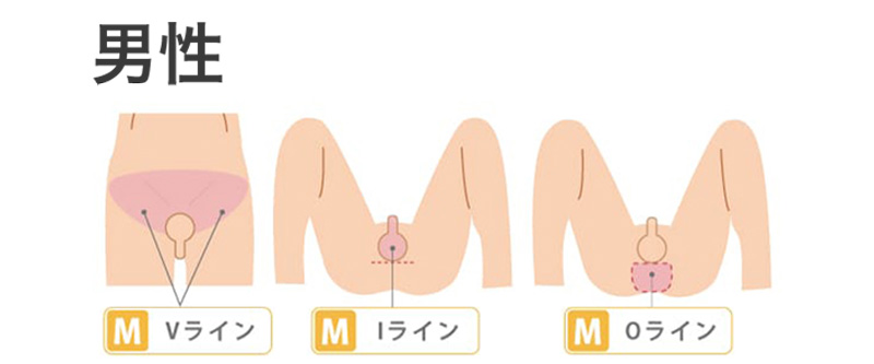 男性のVIO脱毛の部位を示すイメージ