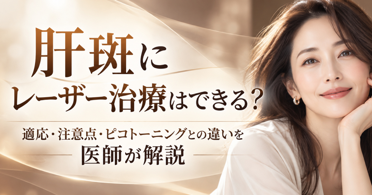 肝斑へのレーザー治療の適応やピコトーニングとの違い