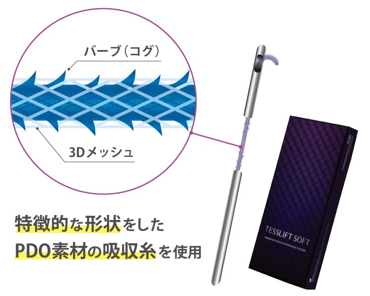 メッシュ型の糸リフトの構造