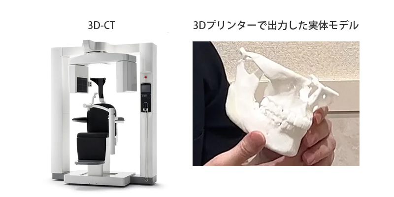 恵聖会の3DCT写真