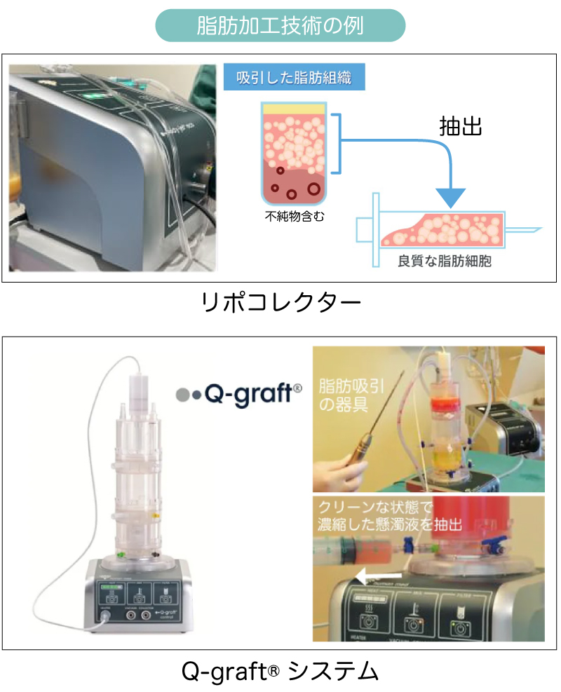 脂肪加工技術の例
