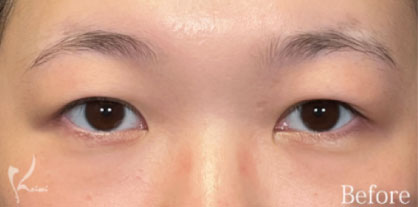 Before写真