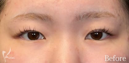 Before写真