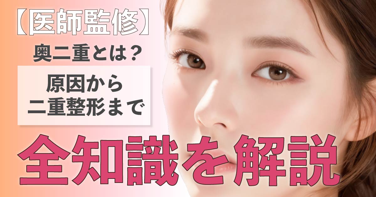 奥二重の特徴や原因、二重整形について解説するイメージ
