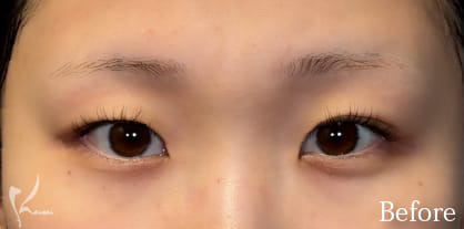 Before写真