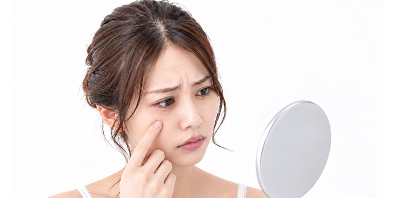 表情ジワが気になる女性