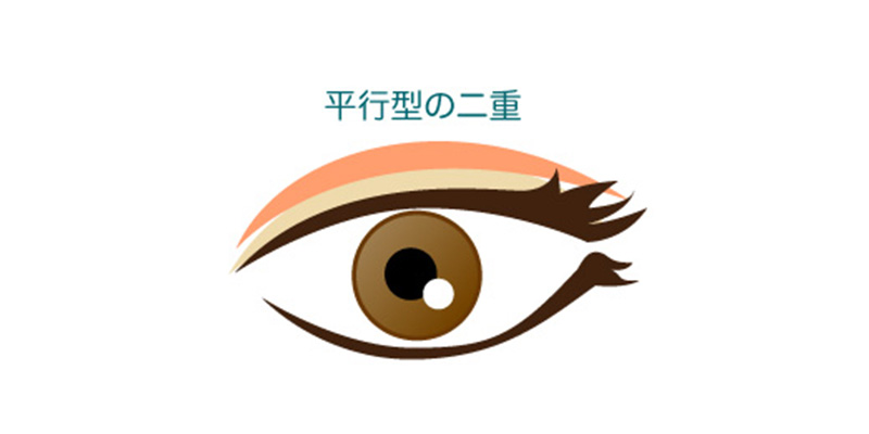 平行二重の形を説明するイメージ
