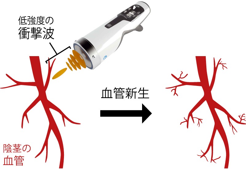 新生血管生成のイメージ図