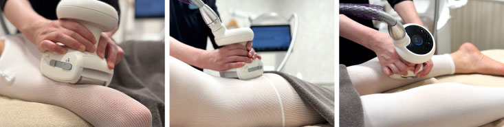 エンダモロジー ダイエット 痩身 メディカルダイエット endermologie　M6 INFINITY（エンダモロジーM6 インフィニティ）施術中写真