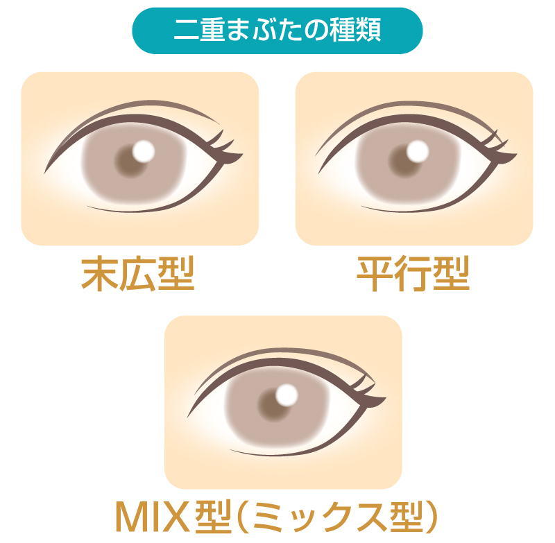  末広型・平行型・MIX型（ミックス型）