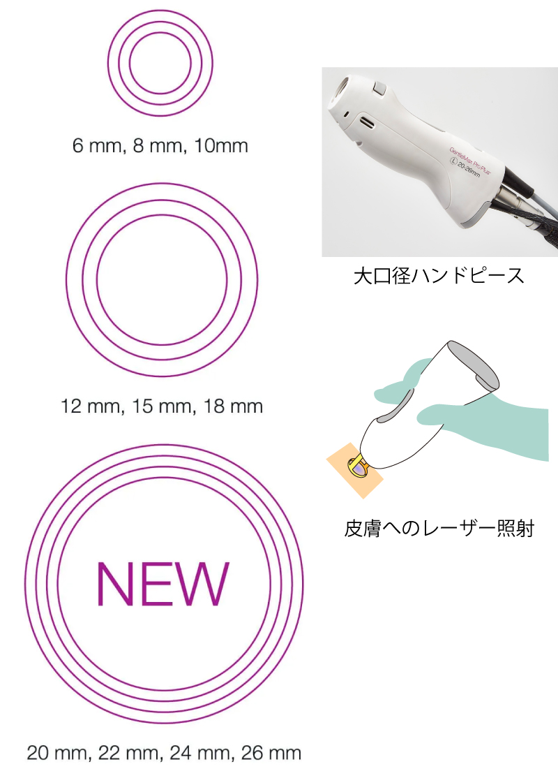 大口径スポットサイズ画像