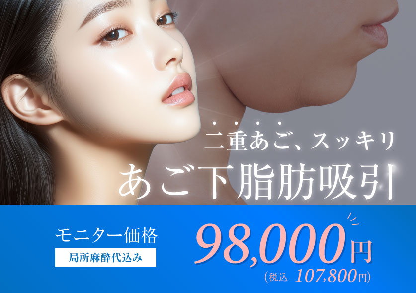 顎下脂肪吸引モニター募集