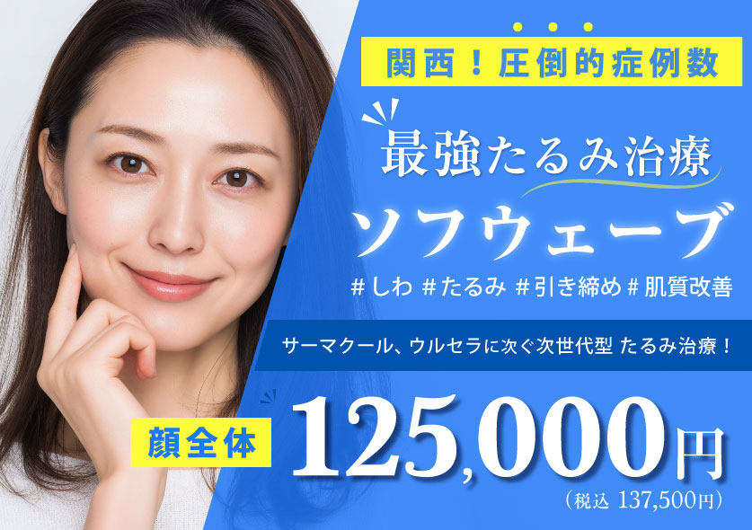 ソフウェーブ　ピックアップバナー