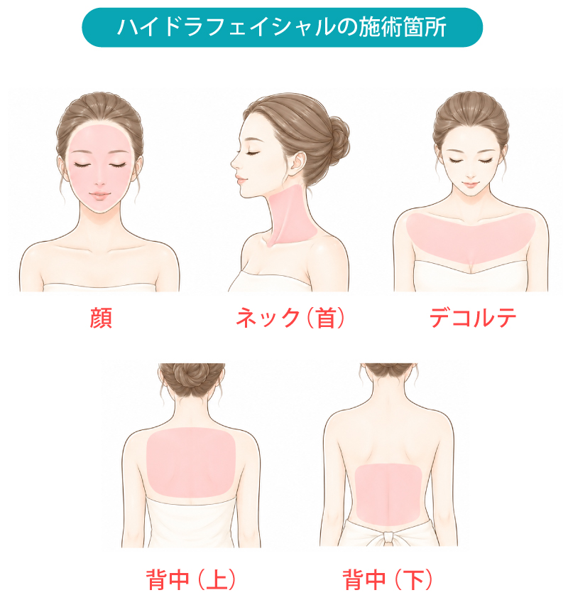 ハイドラフェイシャルの施術箇所