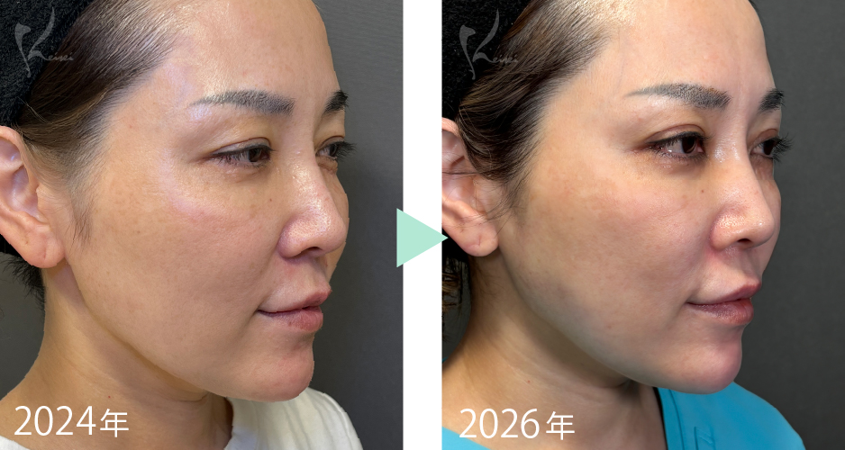 現在と2年前の小西医師の肌の様子