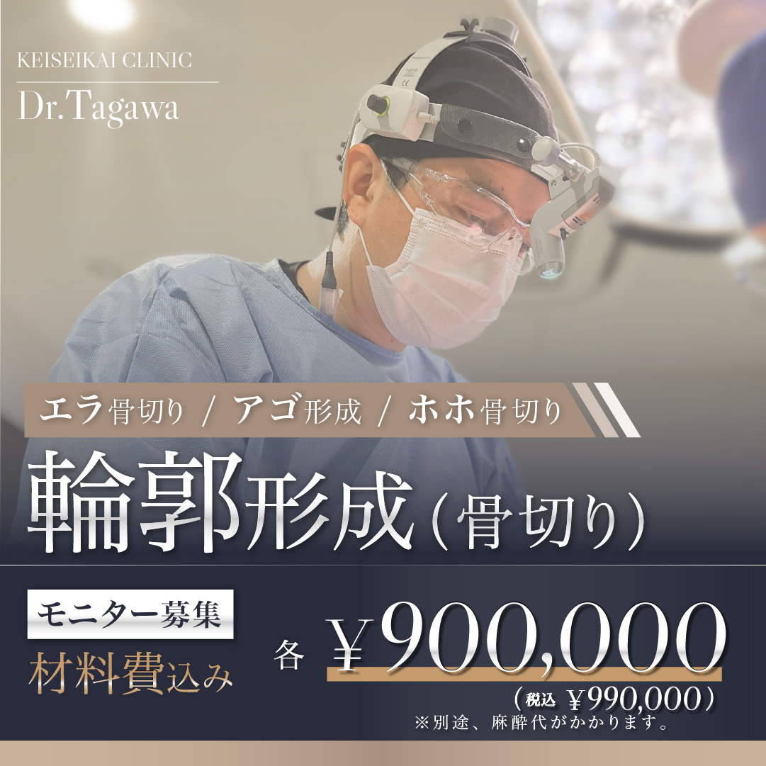 「輪郭形成（骨切り）」モニター募集