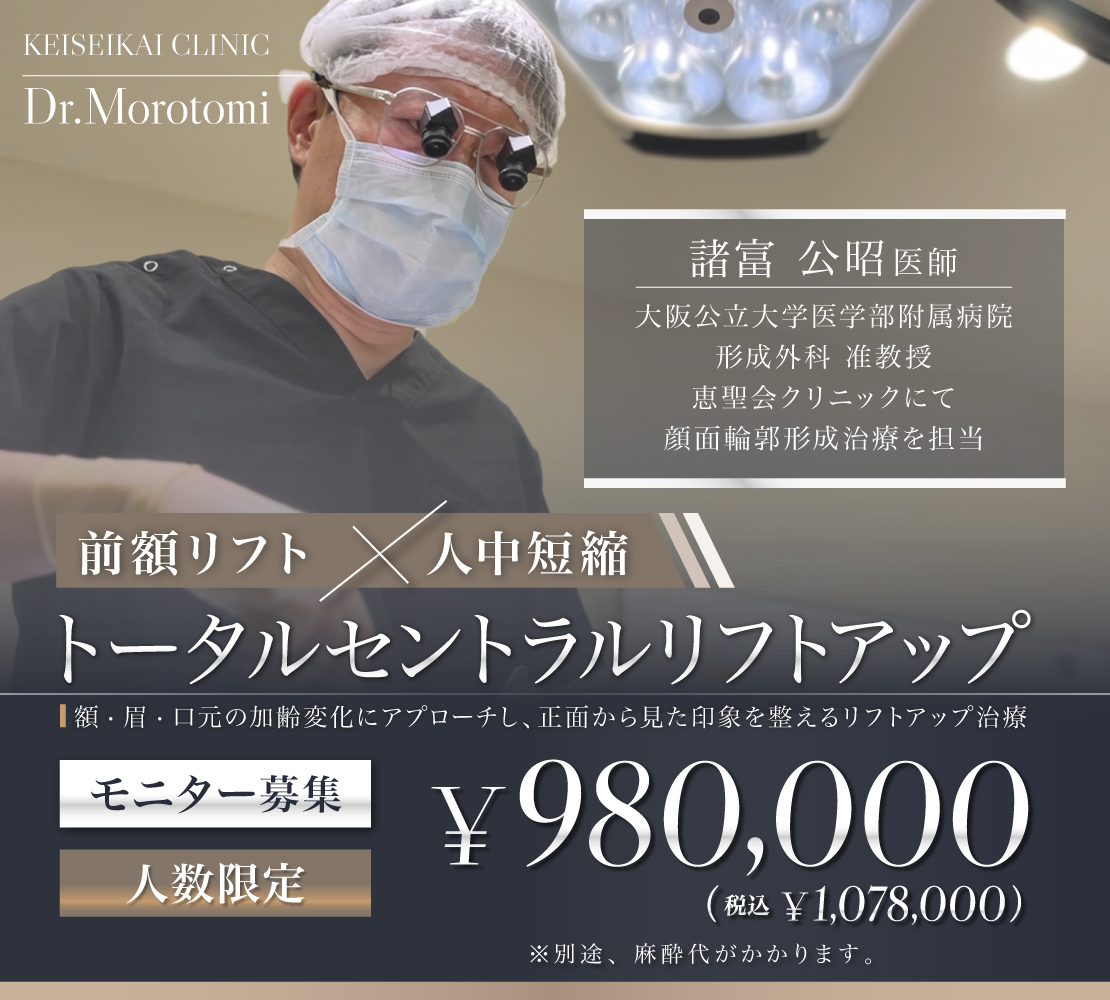 「トータルセントラルリフトアップ」モニター募集