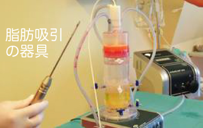 脂肪吸引の器具(写真)