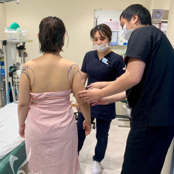 上腕全周の脂肪吸引のためのデザインの様子の画像