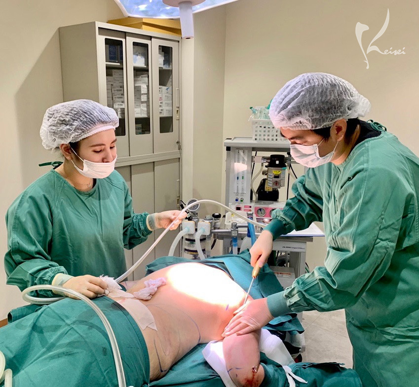 上腕の脂肪吸引手術中の風景の画像