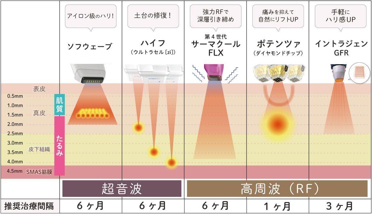 レーザー治療機器比較表