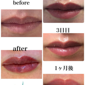 あなたはマスクを外す準備出来ていますか？？