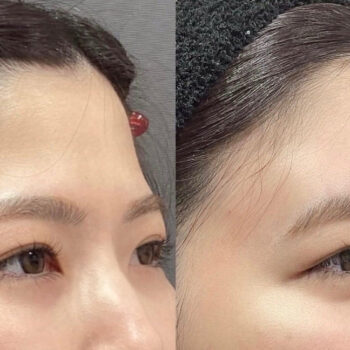 話題の再生医療