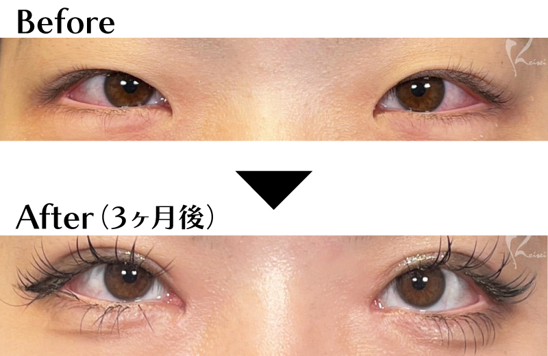 Before & After写真