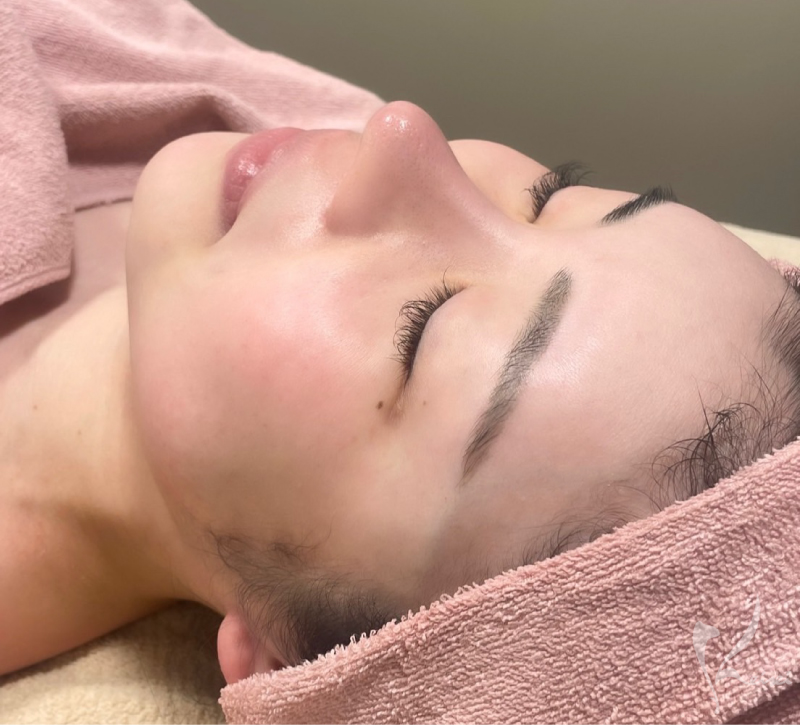 ララピール直後の私のお肌