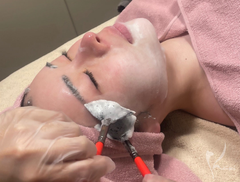 マイクロバブル洗顔の様子