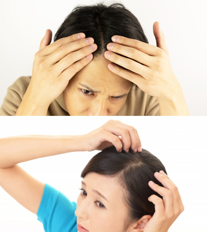 薄毛イメージ