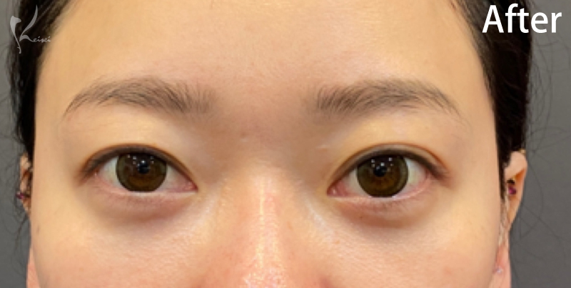 スタッフAfter写真