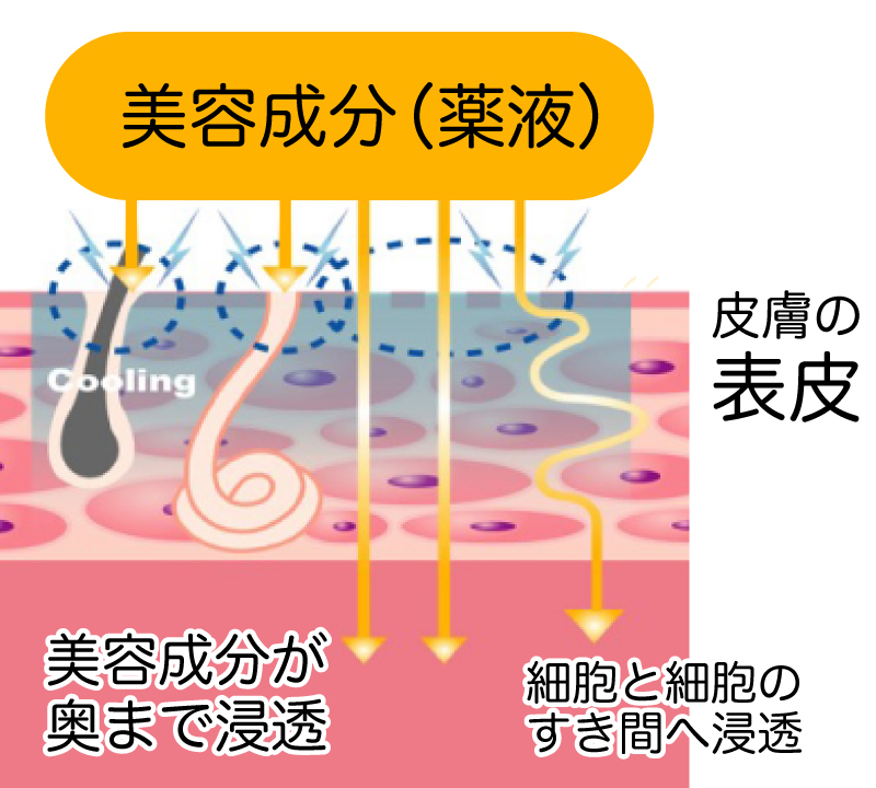 ケアシスの原理