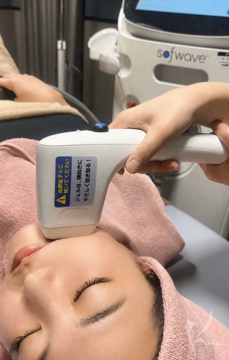 美容クリニックのスタッフがソフウェーブを受けるイメージ