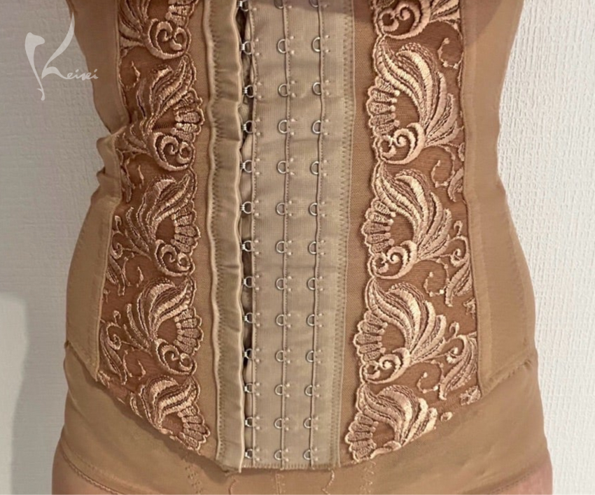 お腹の脂肪吸引　術後1ヶ月と3ヶ月の様子