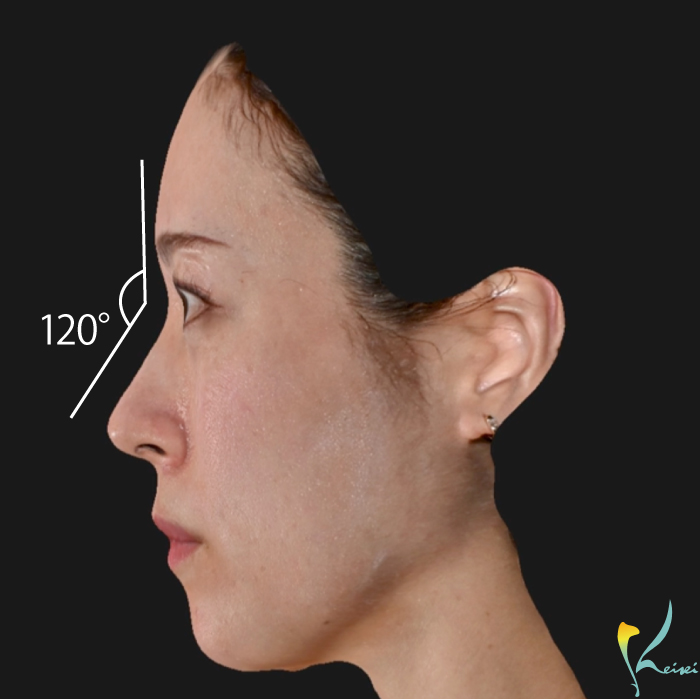 おでこと鼻の角度が120°