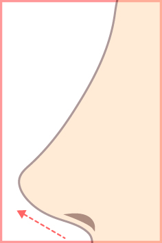 アップノーズイラスト