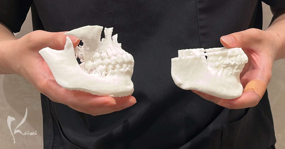 エラの張り具合の違い