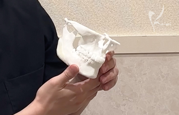 骨切りの際に使うプロテクター