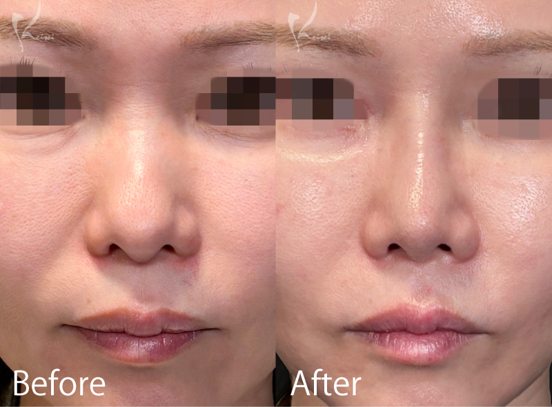 症例1写真1枚目