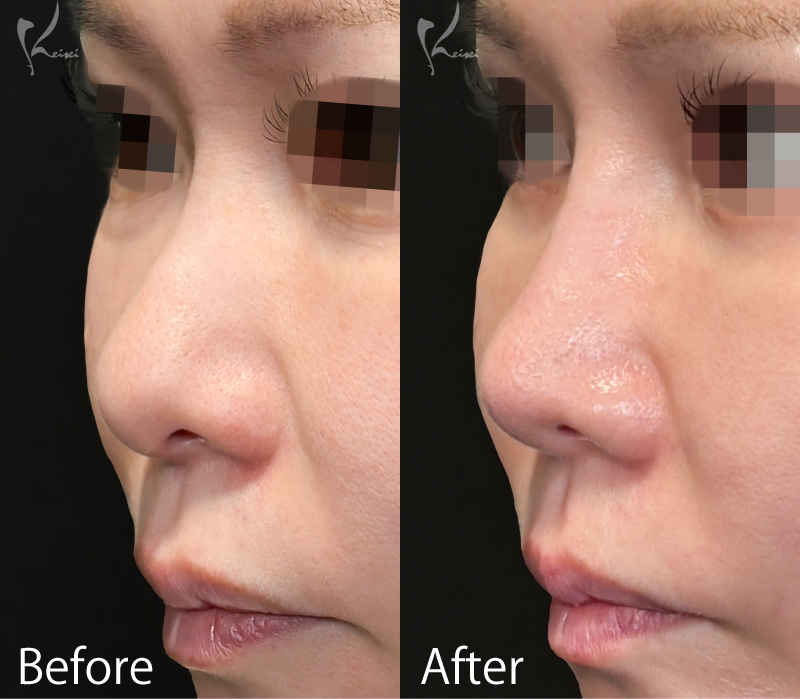 症例1写真2枚目