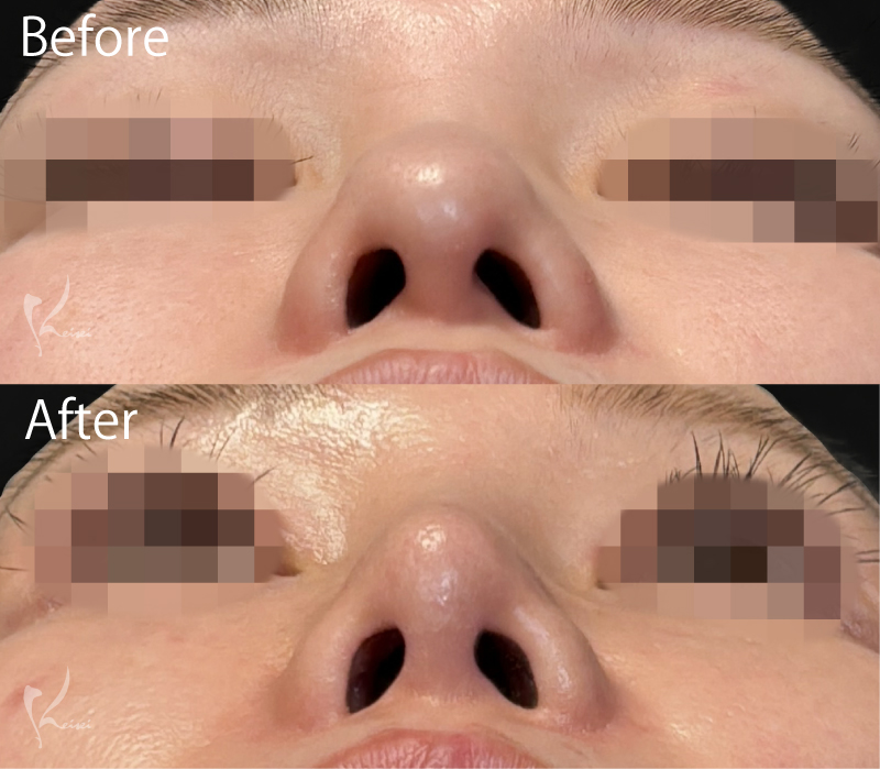 症例1写真4枚目