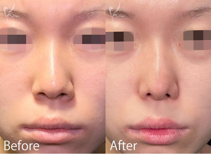 症例2写真1枚目