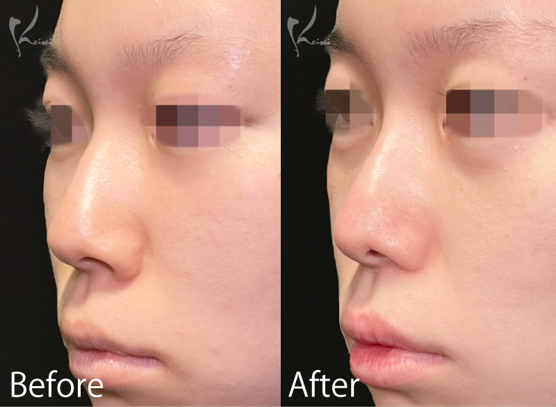 症例2写真2枚目